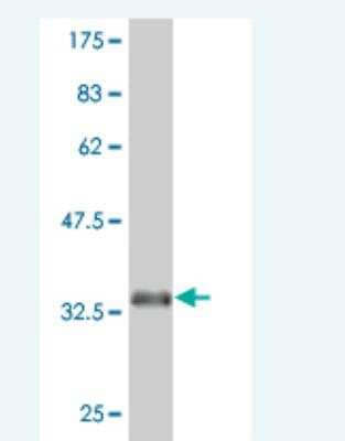 Western Blot: EphA5 Antibody (6F4) [H00002044-M03]