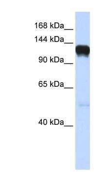 Western Blot: EphA5 Antibody [NBP1-53105]