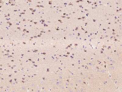 Immunohistochemistry-Paraffin: EphA6 Antibody [NBP2-98327]