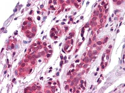 Immunohistochemistry-Paraffin: EphA7 Antibody (6C8G7) - BSA Free [NBP1-47425]