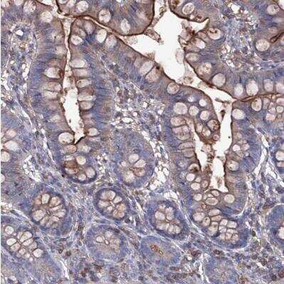 Immunohistochemistry-Paraffin: EphA8 Antibody [NBP1-84893]