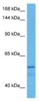 Western Blot: EphA8 Antibody [NBP3-10674]