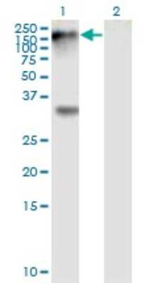 Western Blot: EphB1 Antibody (4G6) [H00002047-M01]