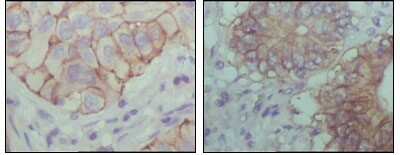 Immunohistochemistry-Paraffin: EphB1 Antibody (5F10A4) - BSA Free [NBP1-28887]