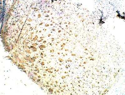 Immunohistochemistry-Paraffin: EphB1 Antibody [NBP3-12305]