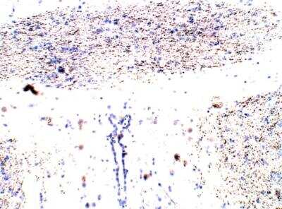 Immunohistochemistry-Paraffin: EphB1 Antibody [NBP3-12305]