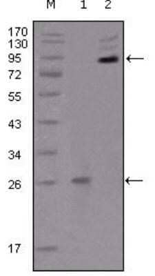 Western Blot: EphB2 Antibody (2D12C6)BSA Free [NBP1-47525]