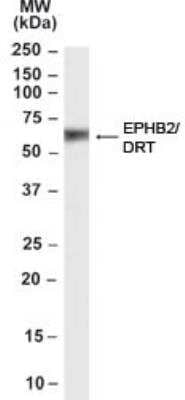 Western Blot: EphB2 Antibody [NB100-55398]