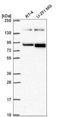 Western Blot: EphB2 Antibody [NBP2-56605]