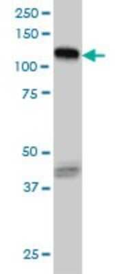 Western Blot: EphB3 Antibody (1B3) [H00002049-M01]