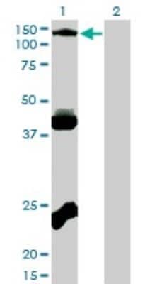 Western Blot: EphB3 Antibody (1B3) [H00002049-M01]