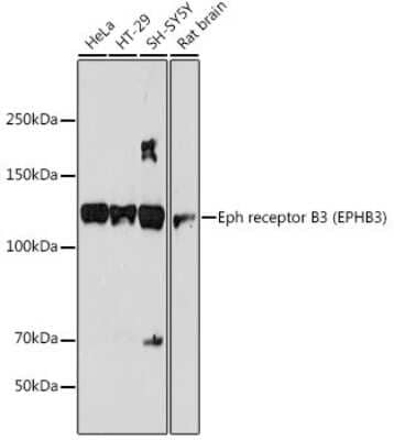 Western Blot: EphB3 Antibody (8H9P4) [NBP3-15693]