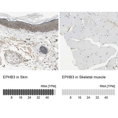 Immunohistochemistry-Paraffin: EphB3 Antibody [NBP1-84776]