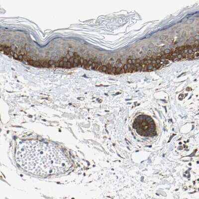 Immunohistochemistry-Paraffin: EphB3 Antibody [NBP1-84777]