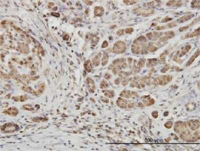 Immunohistochemistry-Paraffin: EphB6 Antibody (5D8) [H00002051-M03]