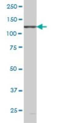 Western Blot: EphB6 Antibody (5D8) [H00002051-M03]