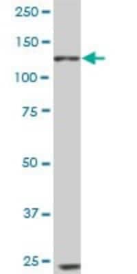 Western Blot: EphB6 Antibody (5D8) [H00002051-M03]