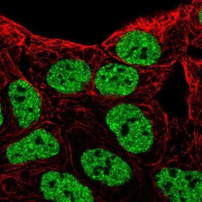 Immunocytochemistry/ Immunofluorescence: EphB6 Antibody [NBP2-58730]