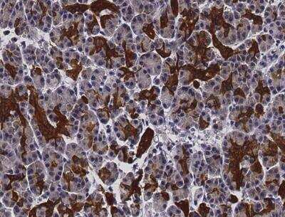 Immunohistochemistry-Paraffin: Ephrin-A1 Antibody (453) [NBP2-89692]