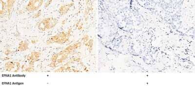 Immunohistochemistry-Paraffin: Ephrin-A1 Antibody [NBP2-99655]