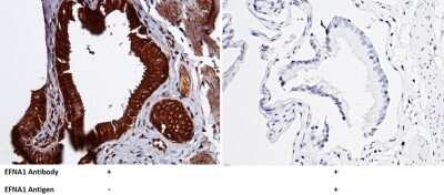 Immunohistochemistry-Paraffin: Ephrin-A1 Antibody [NBP2-99655]