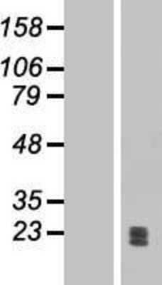 Western Blot: Ephrin-A1 Overexpression Lysate [NBP2-04832]