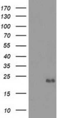 Western Blot: Ephrin-A2 Antibody (OTI3E3) [NBP2-02810]