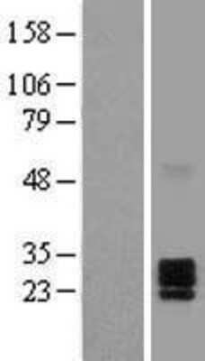 Western Blot: Ephrin-A2 Overexpression Lysate [NBL1-10143]