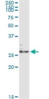 Immunoprecipitation: Ephrin-A3 Antibody (1C12) [H00001944-M02]