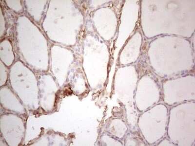 Immunohistochemistry: Ephrin-A3 Antibody (OTI4A4) [NBP2-46484]