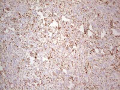 Immunohistochemistry: Ephrin-A3 Antibody (OTI4A4) [NBP2-46484]