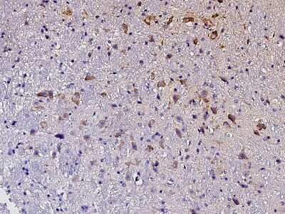 Immunohistochemistry-Paraffin: Ephrin-A3 Antibody [NBP2-98317]