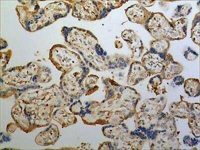 Immunohistochemistry-Paraffin: Ephrin-A3 Antibody (MM0262-7N12) - Azide and BSA Free [NBP2-12279]