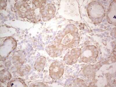 Immunohistochemistry: Ephrin-A3 Antibody (OTI4A4) - Azide and BSA Free [NBP2-70623]