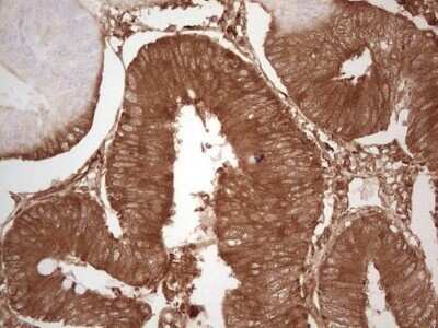 Immunohistochemistry: Ephrin-A3 Antibody (OTI4A4) - Azide and BSA Free [NBP2-70623]