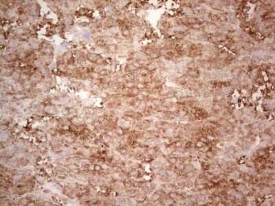Immunohistochemistry: Ephrin-A3 Antibody (OTI4A4) - Azide and BSA Free [NBP2-70623]
