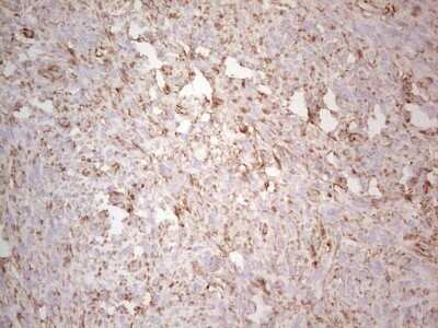 Immunohistochemistry: Ephrin-A3 Antibody (OTI4A4) - Azide and BSA Free [NBP2-70623]