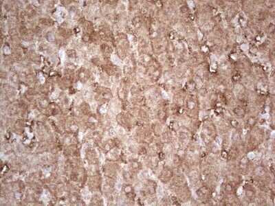Immunohistochemistry: Ephrin-A3 Antibody (OTI4A4) - Azide and BSA Free [NBP2-70623]