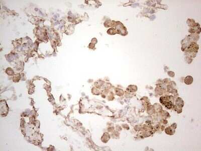 Immunohistochemistry: Ephrin-A3 Antibody (OTI4A4) - Azide and BSA Free [NBP2-70623]