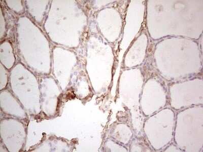 Immunohistochemistry: Ephrin-A3 Antibody (OTI4A4) - Azide and BSA Free [NBP2-70623]