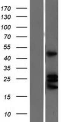 Western Blot: Ephrin-A4 Overexpression Lysate [NBP2-10484]