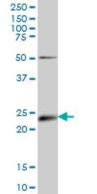 Western Blot: Ephrin-A5 Antibody (1F12) [H00001946-M01]