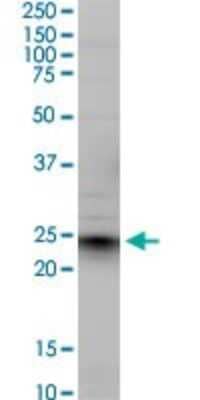 Western Blot: Ephrin-A5 Antibody (1F12) [H00001946-M01]