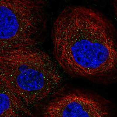 Immunocytochemistry/ Immunofluorescence: Ephrin-A5 Antibody [NBP2-58251]