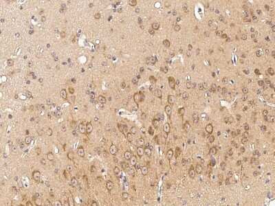 Immunohistochemistry-Paraffin: Ephrin-A5 Antibody [NBP2-98318]