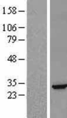 Western Blot: Ephrin-A5 Overexpression Lysate [NBL1-10145]