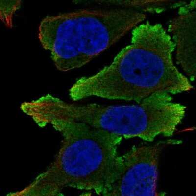 Immunocytochemistry/ Immunofluorescence: Ephrin-B1 Antibody [NBP2-57916]