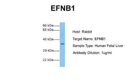 Western Blot: Ephrin-B1 Antibody [NBP1-59211]