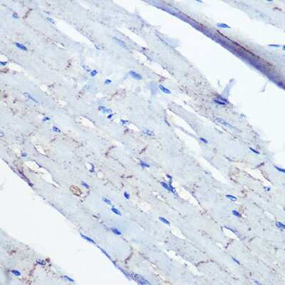 Immunohistochemistry-Paraffin: Ephrin-B2 Antibody (1G9E7) [NBP3-15372]