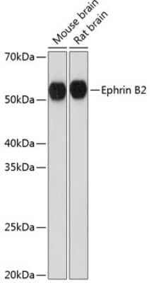 Western Blot: Ephrin-B2 Antibody (1G9E7) [NBP3-15372]